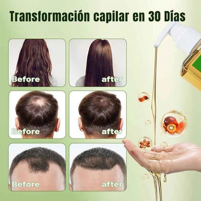 Shampoo de Batana con Extracto de Romero ORIGINAL 💥SUPER OFERTA